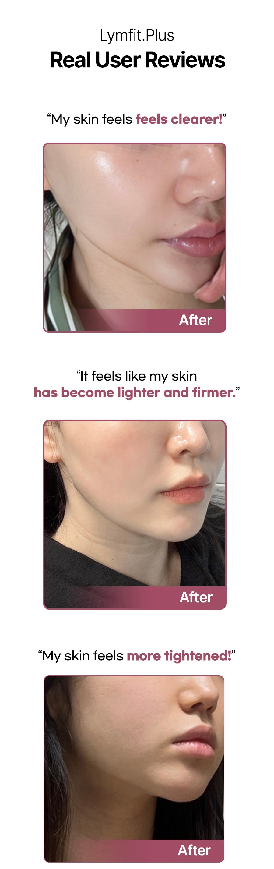 ✨ 全新 Lymfit.Plus 多頻 + HIFU 雙頭專業美容儀 ✨