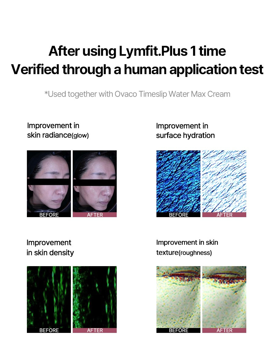 ✨ 全新 Lymfit.Plus 多頻 + HIFU 雙頭專業美容儀 ✨