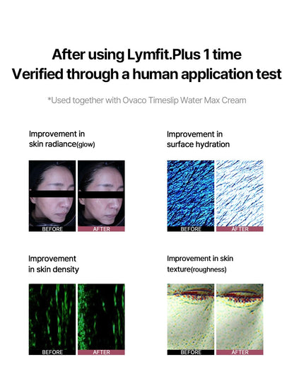 ✨ 全新 Lymfit.Plus 多頻 + HIFU 雙頭專業美容儀 ✨